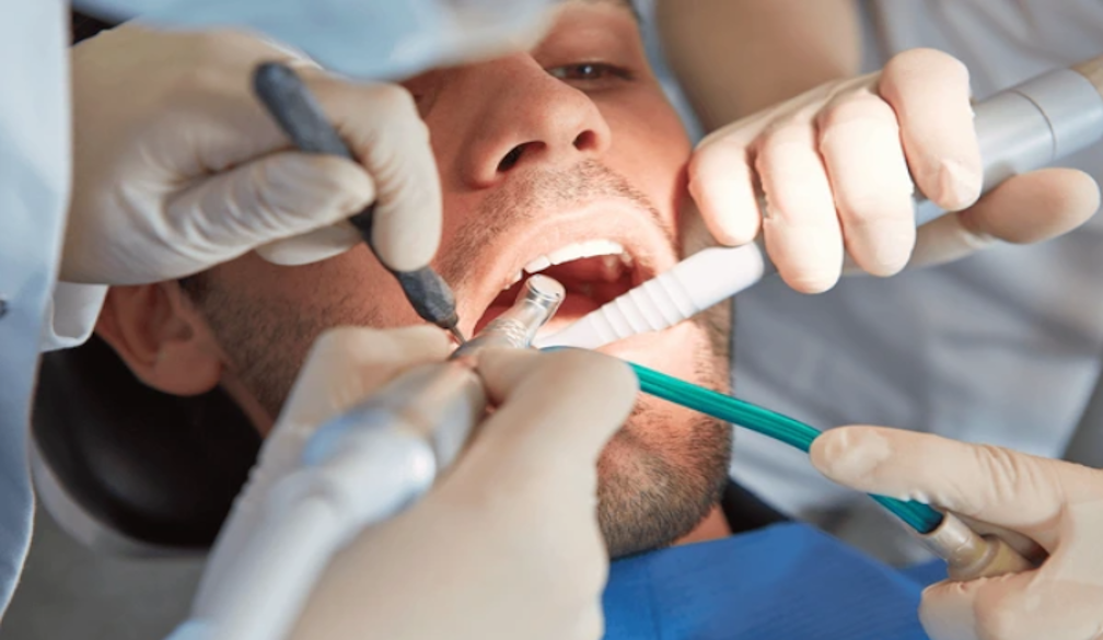 Dental Implant Brisbane
